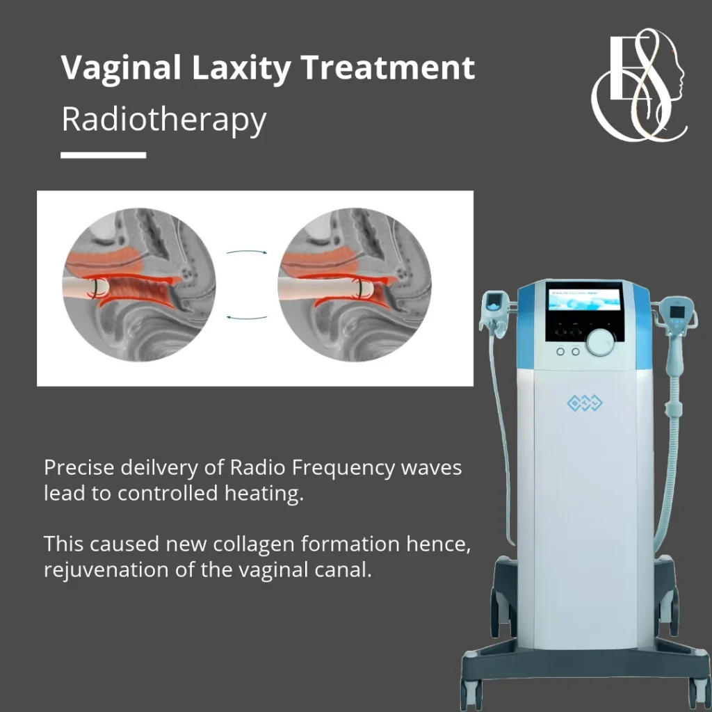 Elle Sante Reconstructive & Cosmetic Gynaecology RF for vaginal tightening Treatment