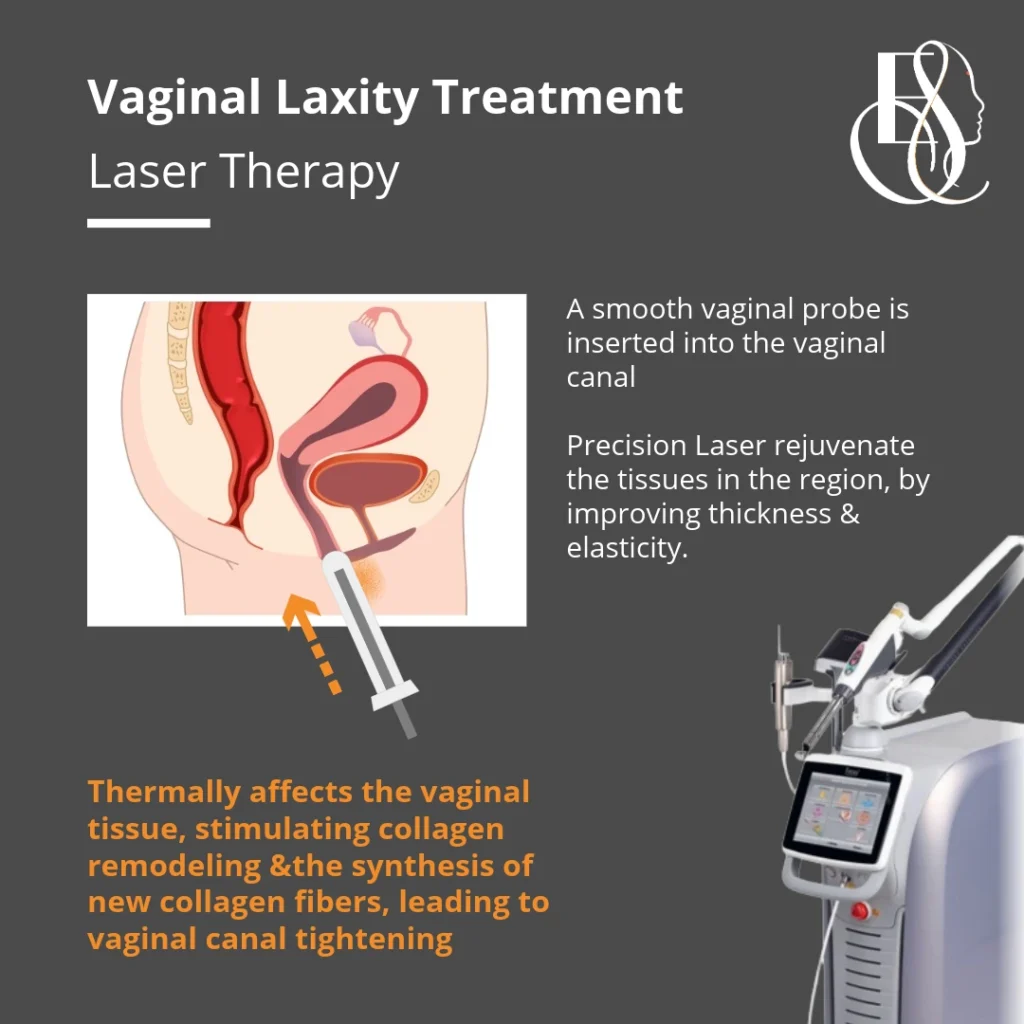 Elle Sante Reconstructive & Cosmetic Gynaecology plasma jet for vaginal tightening Treatment