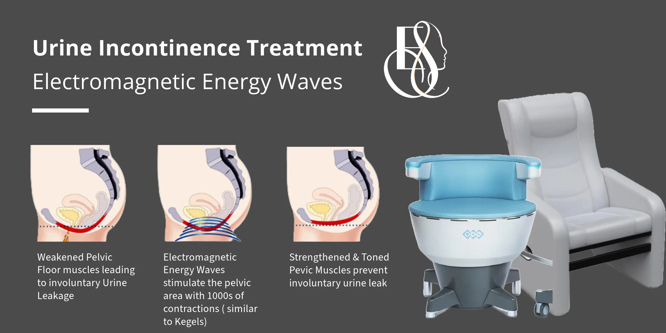 Urine Incontinence Treatment with EM Chairs, Elle Sante Reconstructive & Cosmetic Gynaecology