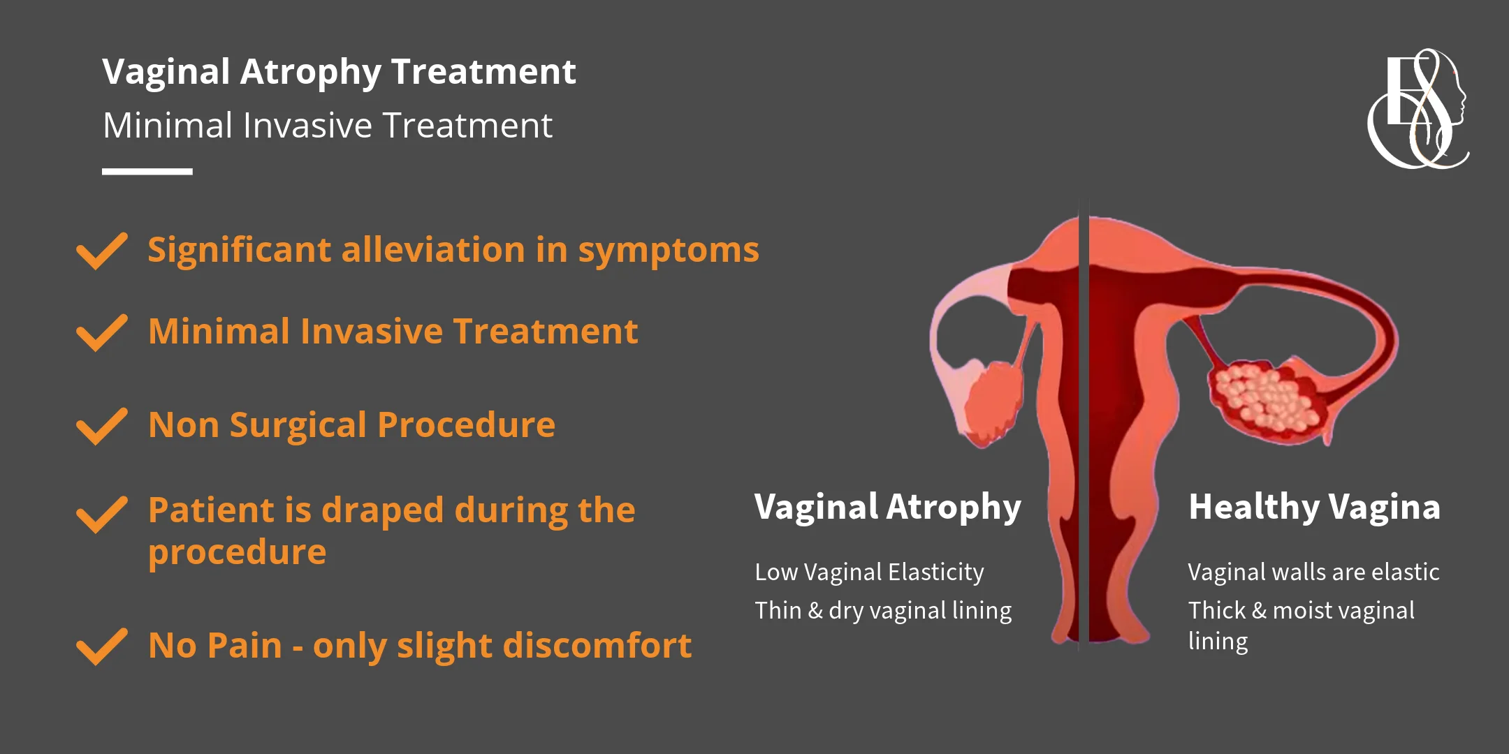 Vaginal Atrophy Treatment Elle Sante Reconstructive & Cosmetic Gynaecology