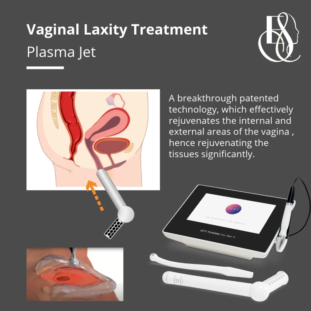 Vaginal Tightening Treatment, Plasma Jet, Elle Sante, Reconstructive & Cosmetic Gynaecology